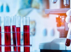 Արցախում կորոնավիրուսի մեկ նոր դեպք կա