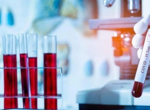 Արցախում կորոնավիրուսի նոր դեպք չի հայտնաբերվել