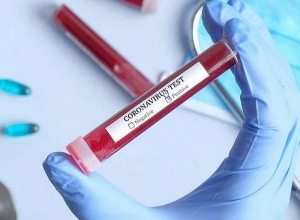 Կորոնավարակը Վրաստանում․ մարտի 3-ի տվյալները․ jnews.ge