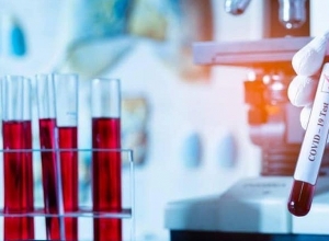 Արցախում կորոնավիրուսային հիվանդության նոր դեպք չի հաստատվել