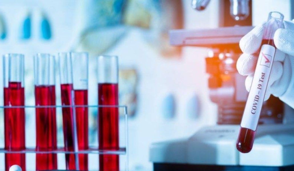 159052495_2830634073876482_1197368460046448778_o