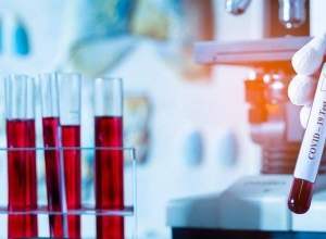 Արցախում կորոնավիրուսային հիվանդության նոր դեպք չի հաստատվել