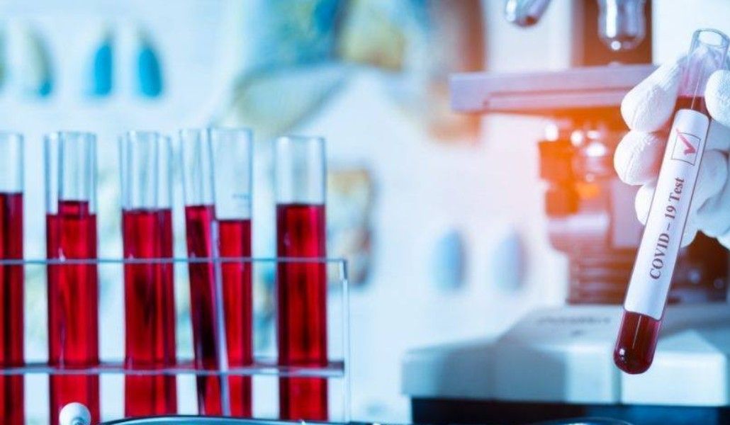 160052690_2832093723730517_212492662343056501_o