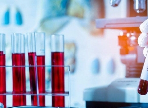 Արցախում հաստատվել է կորոնավիրուսային հիվանդության 2 դեպք