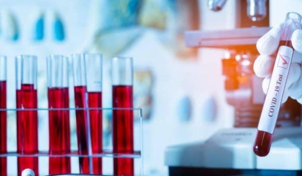 160348675_2833776180228938_311136364536182450_n