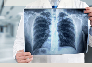 Անվճար ֆլյուորոգրաֆիկ սքրինինգային հետազոտություններ և հանրային իրազեկում