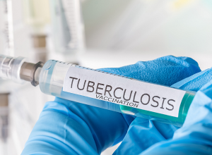 Աշխարհում ամեն օր տուբերկուլոզից մահանում է 4000 մարդ