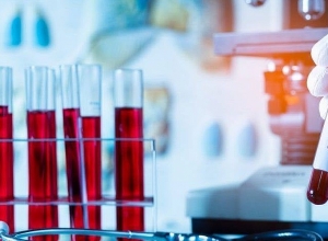 Արցախում հաստատվել է կորոնավիրուսային հիվանդության 7 դեպք