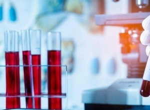 Կորոնավիրուսային հիվանդության իրավիճակը Արցախում