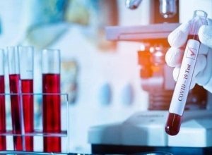 Արցախում հաստատվել է կորոնավիրուսային հիվանդության 4 նոր դեպք