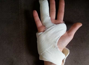 41-ամյա տղամարդը բակում պայթյունի հետևանքով վնասվածքներ է ստացել