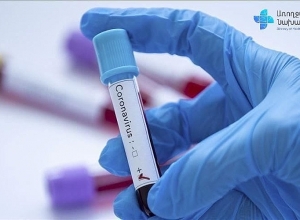 Կորոնավիրուսով վարակման 93 նոր դեպք է հաստատվել․ թարմ տվյալներ