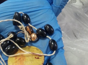 Վաղաշենում ավազակային հարձակման դեպքը բացահայտվել է․ (լուսանկարներ)