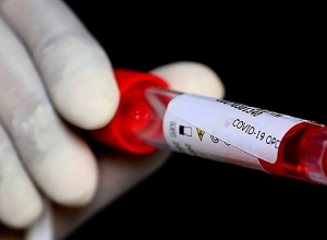 Արցախում կորոնավիրուսով վարակման 71 նոր դեպք է գրանցվել