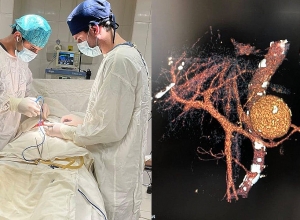 Համալսարանական վիրաբույժները փայծախային զարկերակի հազվադեպ հանդիպող վիրահատություն են կատարել