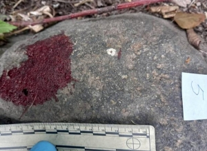 37 և 38 տարեկան 2 տղամարդ դանակահարել էին իրար