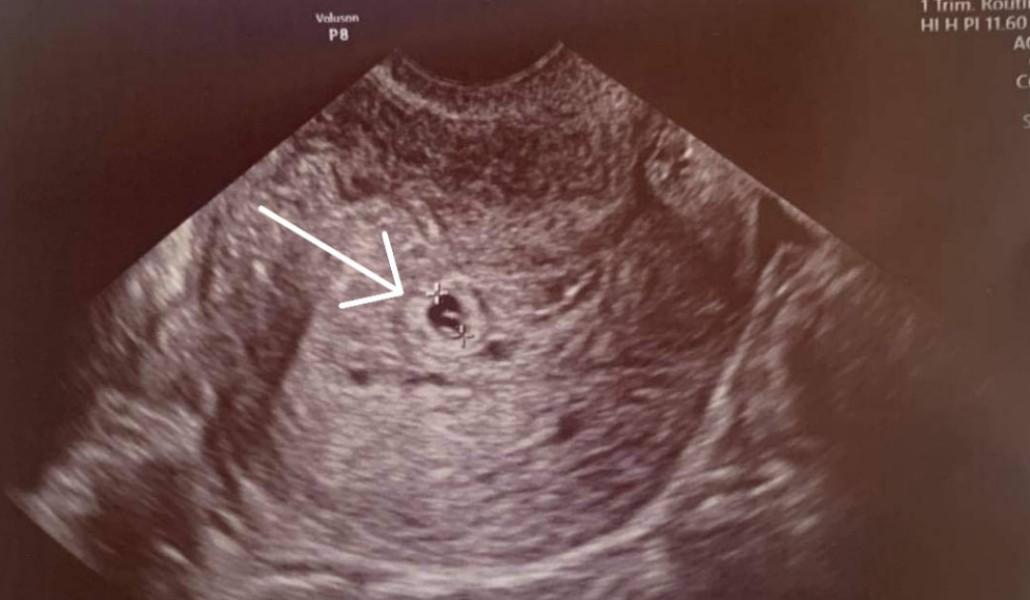 244635667_228068476023346_3229715757272913697_n