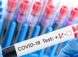 ՊՇՌ թեստավորում իրականացնող մի շարք ընկերություններ դիրքն են չարաշահե՞լ