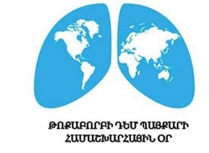 Թոքաբորբի դեմ պայքարի համաշխարհային օրն է․ աշխարհում տարեկան 450 միլիոն մարդ հիվանդանում է թոքաբորբով