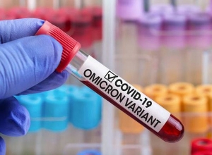 Վրաստանում «օմիկրոն»-ով վարակման 24 դեպք է գրանցվել