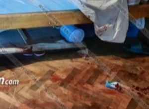 Երևանի բնակիչ 24-ամյա աղջիկը թմրանյութի հետևանքով ցնցումների մեջ է ընկել, վնասել ձեռքը․ Shamshyan.com