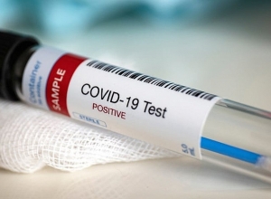 Сколько новых случаев Covid было зарегистрировано на прошлой неделе?