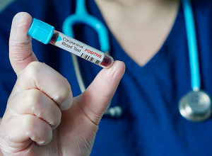 Վրաստանում արձանագրվել է կորոնավիրուսի 3 840 նոր դեպք