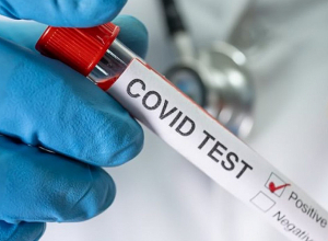 COVID-19-ով վարակման դեպքերի թիվն աշխարհում մոտենում է 651 միլիոնի