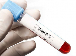 Հեպատիտ «Ց»-ի բուժման պետական ծրագիրն արդյունավետ գործում է