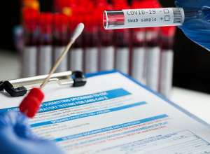 2 новых случая смерти и 91 положительный тест: коронавирус за неделю