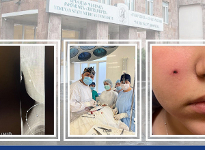 Երեխան  ստացել է խաղալիք ատրճանակից հարված․ այտային շրջանի փափուկ հյուսվածքներում մետաղական գնդիկ է մնացել