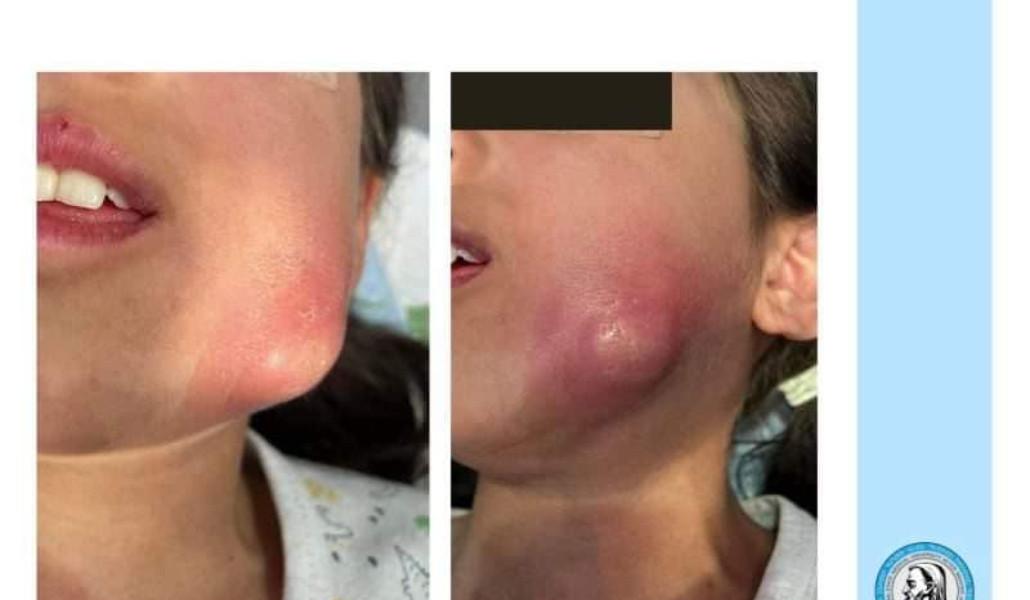 278347300_530191521810857_1486225088928100619_n