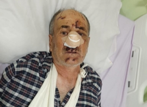 Վայոց ձորում արջը հարձակվել է բոխի հավաքող տղամարդու վրա. shamshyan.com 