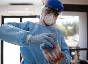 Եվրոպական տարածաշրջանում Կապիկի ծաղիկի բռնկման վտանգը մեծացել է