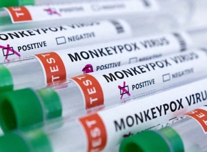 Պատրաստ է արդյո՞ք ԱՄՆ-ն կապիկի ծաղիկի հնարավոր բռնկմանը