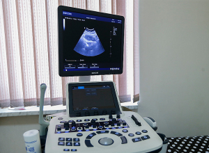 Համայնքային ենթակայության 8 բուժհաստատություն համալրվել է ուլտրաձայնային ստացիոնար հետազոտության սարքավորումներով