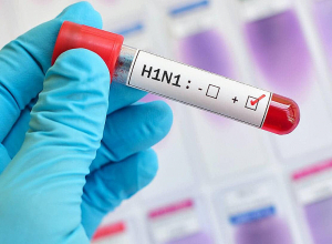 Հայաստանում հաստատվել է գրիպի Ա տեսակի H1N1 ենթատեսակի վիրուսի հարուցիչ
