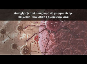 «Всемирный день борьбы против рака: какова картина в Армении»: обсуждение на тему в прямом эфире