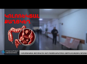 Скрининговая программа раннего выявления колоректального рака продлится до 2026 года.