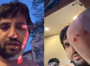 Անհայտ անձինք հարձակվել են Վրաստանի հայ համայնքի նախագահի վրա. Jnews.gr