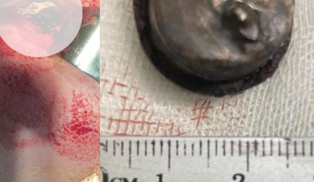 360111349_666846558811408_6752540958604742222_n