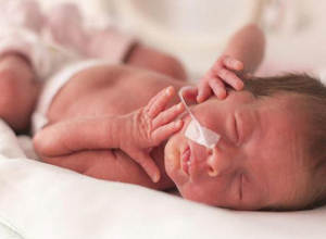 Էքստրեմալ ցածր քաշով անհաս նորածինների սնուցման համար անհրաժեշտ դեղը կտրամադրվի անվճար