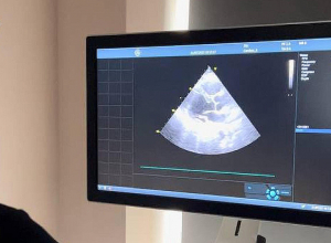 50% զեղչ սրտաբանի խորհրդատվության եւ մի շարք հետազոտությունների համար՝ «Բեսթ լայֆ» ԲԿ-ում