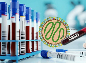 Չինաստանում մարդու մետապնևմովիրուսային վարակի բռնկում է