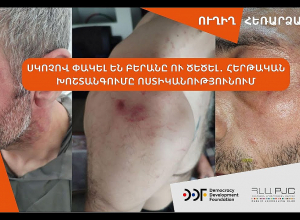 «Սկոչով փակել են բերանը ու ծեծել․ հերթական խոշտանգումը ոստիկանությունում»․ ՈՒՂԻՂ